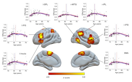 图1. 认知控制相关的大脑活动的毕生发展轨迹